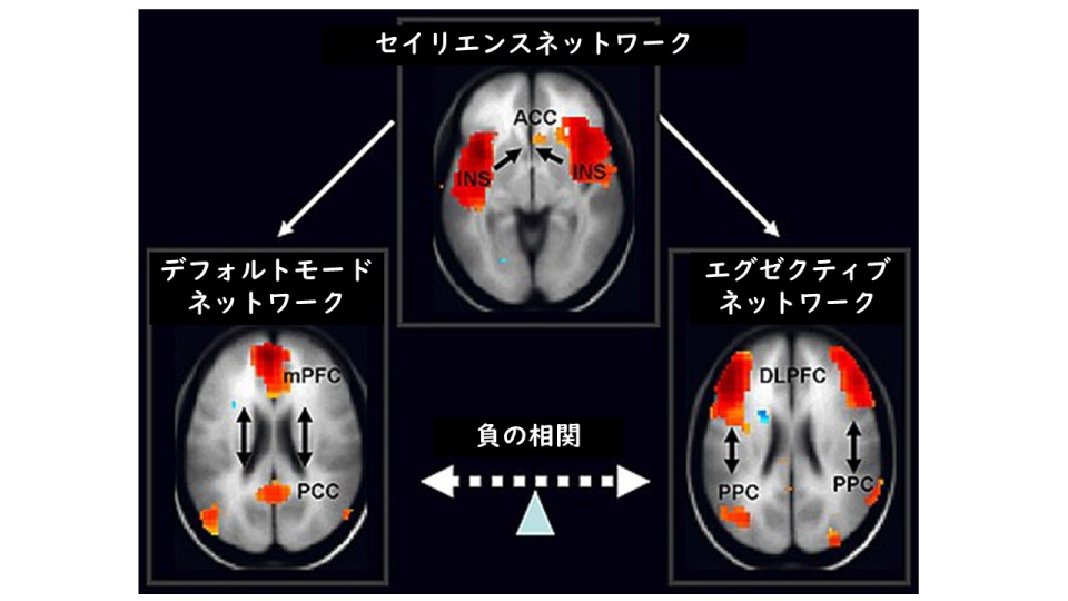 criatividade, humanos, cérebro