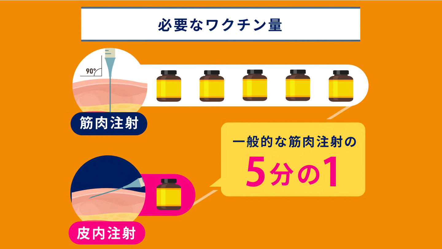 トロデルヴィの使い方