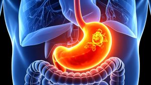 胃ガンの幹細胞（12月18日 Science 掲載論文） - Lab BRAINS