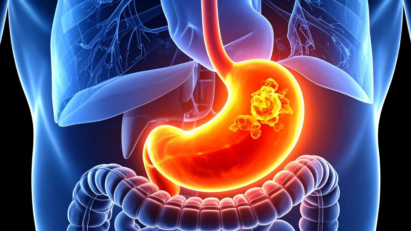 胃ガンの幹細胞（12月18日 Science 掲載論文） - Lab BRAINS